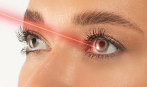 Chirurgie des yeux en Belgique